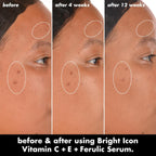 e.l.f. SKIN Bright Icon Vitamin C + E + Ferulic Serum. 1 oz | Brightening Serum with 15% Vitamin C. 1% Vitamin E & 0.5% Ferulic Acid. Helps the Look of Dark Spots. Vegan & Cruelty-Free