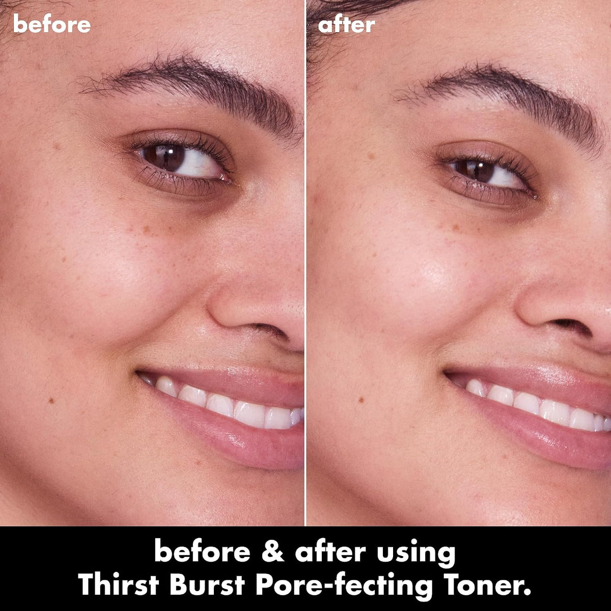 e.l.f. SKIN Thirst Burst Pore-fecting Toner. Hydrating for Face. Smooths. Plumps & Minimizes Pores. Infused with Salicylic Acid. Vegan & Cruelty-Free