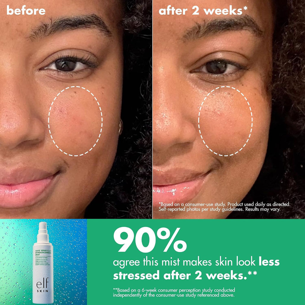 e.l.f. SKIN Save Your s.e.l.f. Hypochlorous Mist | Dermatologist-Developed Facial Spray. Soothes & Calms Redness. Sensitive & Blemish-Prone Skin. Vegan & Cruelty-Free