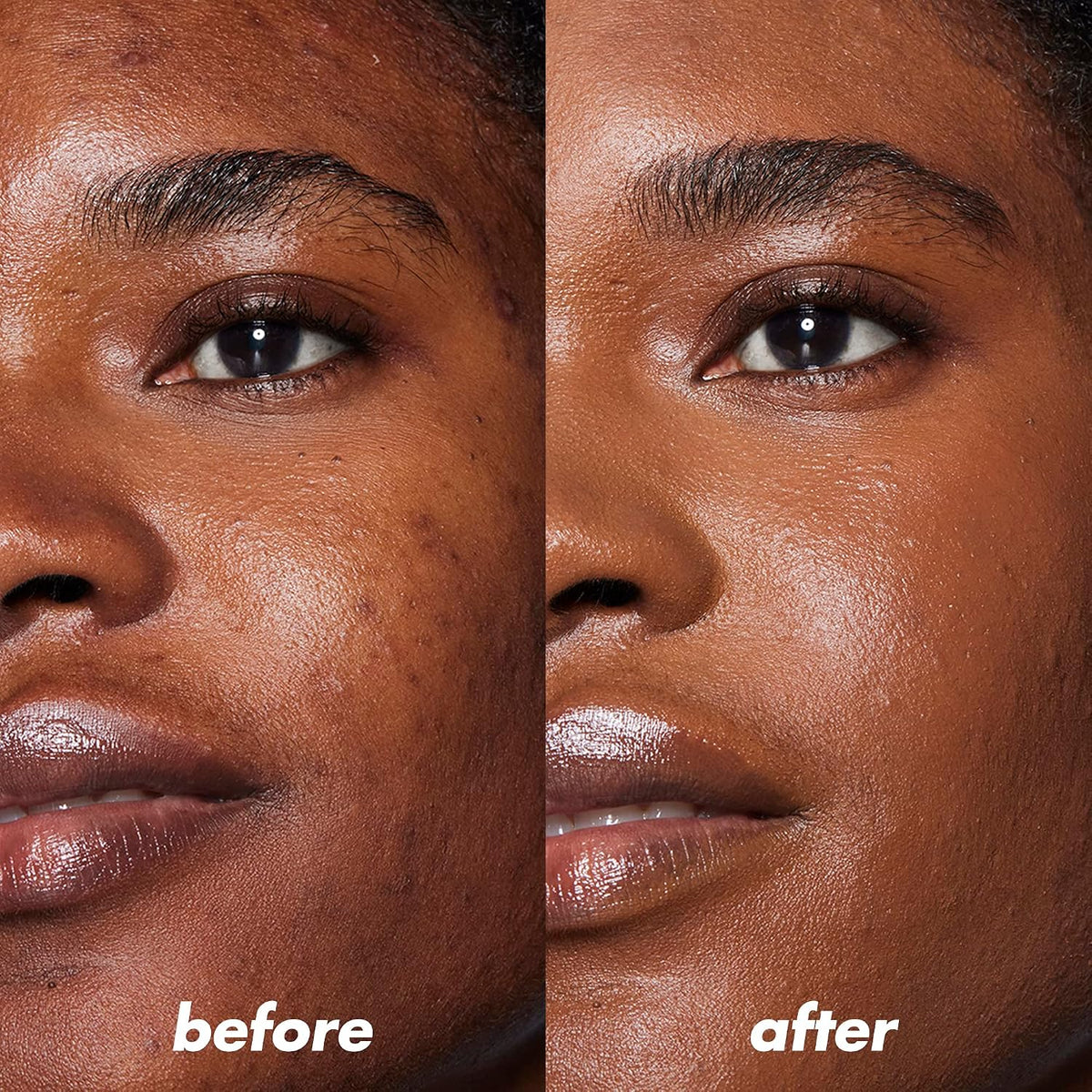 e.l.f. Camo Color Corrector for Dark Circles. Hydrating Under-Eye Brightening Concealer. Neutralizes Discoloration. Infused with Hyaluronic Acid. Orange